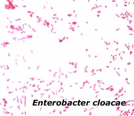 Tìm ra vi khuẩn gây béo phì