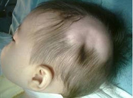 Những ca bệnh hy hữu do bất cẩn trong năm 2012 - 2 Bé Hồ G. H lúc vừa nhập viện