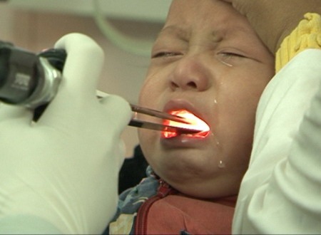 Trẻ nhỏ dễ mắc các bệnh về đường hô hấp