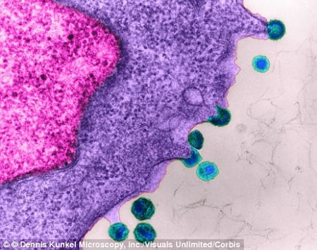 Vi rút HIV trưởng thành (tế bào màu xanh)