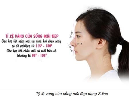 Nâng mũi S-line là gì? - 2 Phẫu thuật nâng mũi S-line là một trong những kỹ thuật nâng mũi mới nhất hiện nay.
