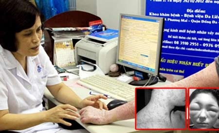 Thảm hại vì đem mặt ra làm “chuột bạch” - 1 Ảnh minh họa.
