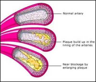 Cholesterol thay đổi theo mùa - 1 Tiến sĩ Filipe Moura cùng nhóm nghiên cứu của mình tại Đại học quốc gia