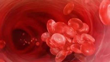 Steroid làm tăng nguy máu đông cục - 1 Steroid có thể làm tăng nguy cơ xuất hiện các cục máu đông nguy hiểm