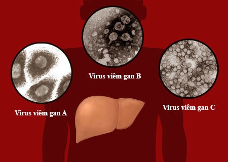 Viêm gan vì không ăn cơm với... vợ - 2 Không ăn cơm với vợ - Gan “bội thực” dinh dưỡng