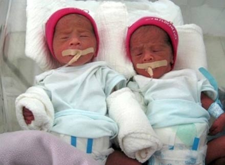 Sinh 4 - 5 nhờ hỗ trợ sinh sản: Thành tích hay thất bại của y học? - 2 Hai trẻ 1,3kg trong ca sinh năm đang được theo dõi đặc biệt tại khoa Nhi Sơ sinh, BV Từ Dũ.