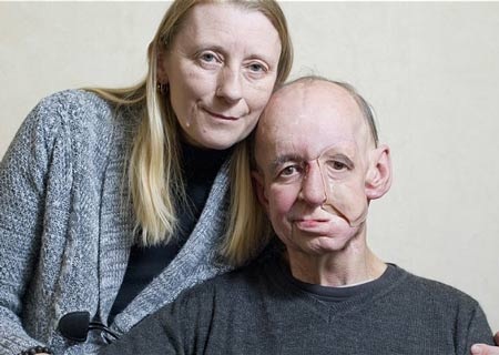 Ông Eric Moger hiện tại