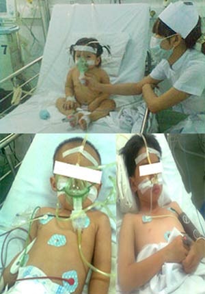 Cứu sống 3 trường hợp trẻ bị suyễn cơn nặng, nguy kịch - 1 3 bệnh nhi đang được điều trị tích cực tại BV Nhi đồng 1