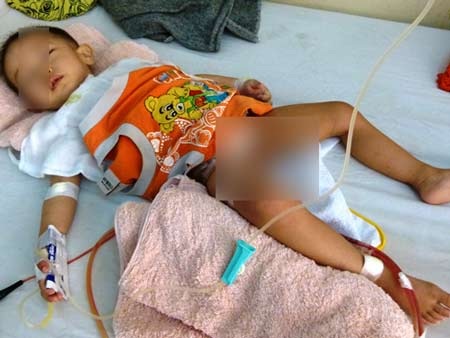 Bé bị cắt nhầm bàng quang về lại Khánh Hòa điều trị - 1 Bé T.A.Đ sau ca mổ cấp cứu thông tiểu tại Bệnh viện đa khoa Khánh Hòa. Ảnh tư liệu NLĐO