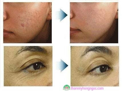 Trẻ hoá da bằng công nghệ thẩm mỹ mới ETWO - 3 Chương trình tư vấn trẻ hóa da thu hút sự tham gia của đông đảo phụ nữ