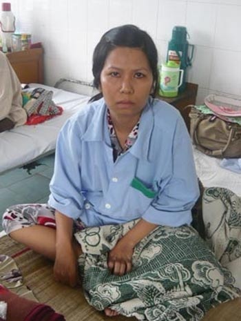 Liên tiếp các vụ bệnh nhân bị cắt thận, cưa chân kiện bác sĩ, bệnh viện - 1 Bệnh nhân Hứa Cẩm Tú bị cắt nhầm 2 quả thận vẫn phải mỏi mòn đi kiện. Ảnh: H.D