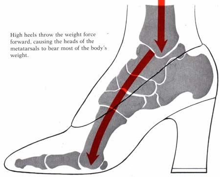 Không rời giày cao gót suốt 8 tiếng