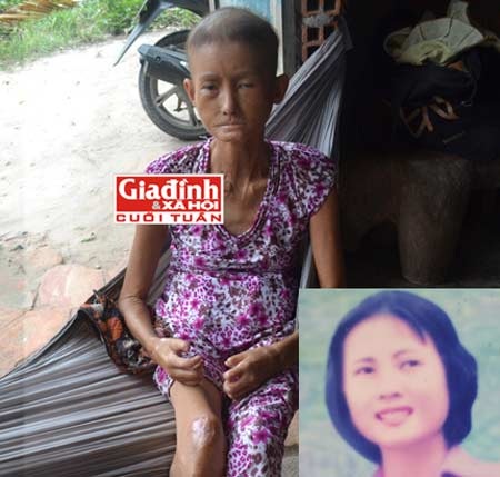 Căn bệnh kỳ lạ biến “hoa khôi” miệt vườn sau một đêm hóa thành… bà lão - 1 Căn bệnh kỳ lạ biến “hoa khôi” miệt vườn sau một đêm hóa thành… bà lão