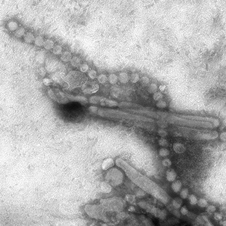 Vi-rút cúm H7N9 dưới kính hiển vi điện tử