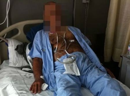 Phải cắt bỏ “cậu nhỏ” vì uống Viagra quá liều - 1 Bệnh nhân sau khi phẫu thuật cắt bỏ dương vật