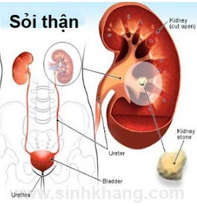 Nhiều cách chữa nhưng hay tái phát