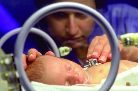 Mổ đẻ không làm giảm nguy cơ bại não - 1 Mổ đẻ không làm giảm nguy cơ bại não