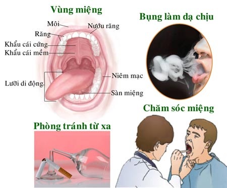 Ung thư miệng: Phòng bệnh được từ xa quý chừng nào! - 1 Vết loét không chịu lành