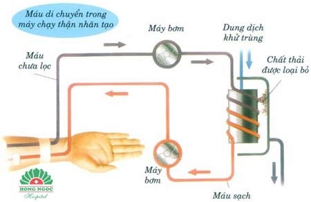 BV Hồng Ngọc miễn phí 10 ca chạy thận nhân tạo tại Hà Nội - 1 Chạy thận nhân tạo được thực hiện khi chức năng thận suy yếu