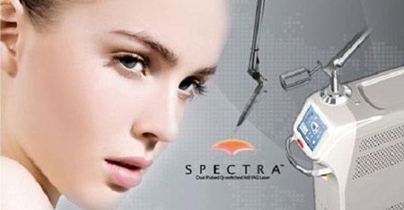 Trị nám da hiệu quả bằng công nghệ mới Spectra Laser - 2 Điều trị nám da bằng công nghệ Spectra Nrd Yag Laser