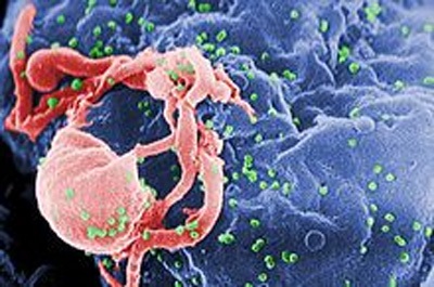 Lần đầu tiên tổng hợp được phân tử ngăn chặn sự nhân lên của HIV - 1 Lần đầu tiên tổng hợp được phân tử ngăn chặn sự nhân lên của HIV