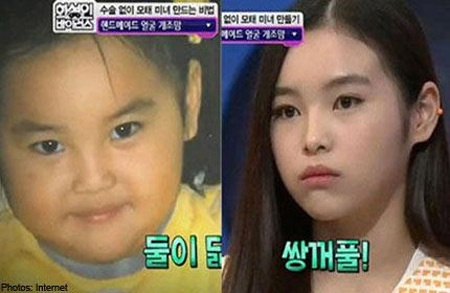 Mẹ Hàn Quốc “nắn” mặt cho con bằng mát-xa và thìa - 1 Mẹ Hàn Quốc “nắn” mặt cho con bằng mát-xa và thìa