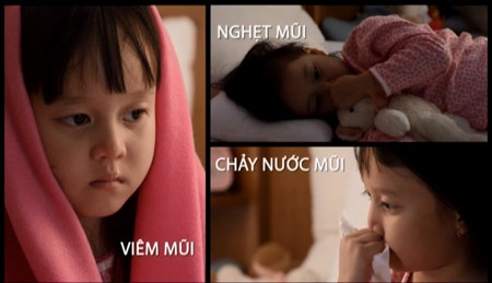 Viêm mũi dị ứng ở trẻ em - 1 Viêm mũi dị ứng ở trẻ em