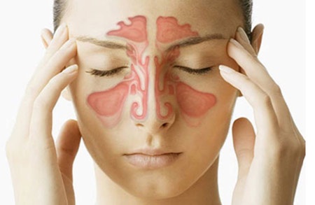 Các triệu chứng viêm mũi