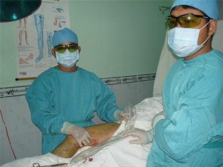 Nổi gân xanh, hành suýt chết! - 1 Phẫu thuật điều trị bệnh suy tĩnh mạch tại Bệnh viện Nhân dân 115 TPHCM