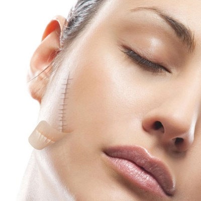 Có thuốc làm mất sẹo? - 1 Có thuốc làm mất sẹo?