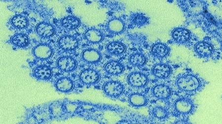 Thái Lan: Đã có 18 người chết do cúm H1N1