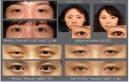 Trẻ hóa toàn diện tại Thẩm mỹ Hàn Quốc JW mừng 30/04 &1/05 - 11 C