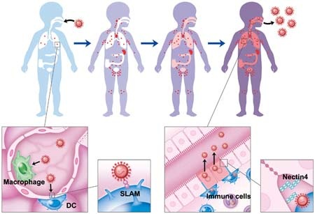 Bạn có thể bị mắc sởi như thế nào? - 1 Có thể bị mắc sởi như thế nào?
