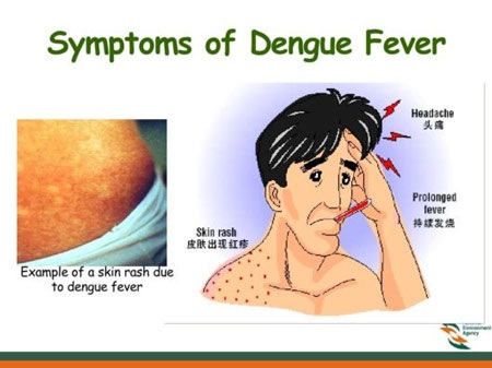 Sốt xuất huyết: Đừng để trở tay không kịp! - 1 1. Triệu chứng