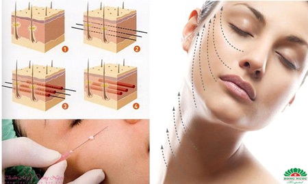 Nâng cơ mặt bằng chỉ với chuyên gia Hàn Quốc - 1 Vui lòng liên hệ Hotline: 0915 810 138 hoặc 0915 810 134