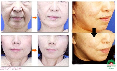 Nâng cơ mặt bằng chỉ với chuyên gia Hàn Quốc - 3 Vui lòng liên hệ Hotline: 0915 810 138 hoặc 0915 810 134