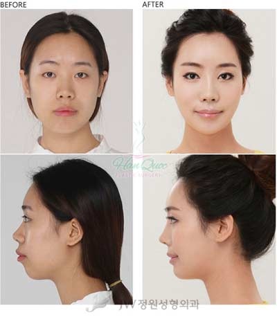 Thẩm mỹ JW - Thương hiệu thẩm mỹ Hàn Quốc chính thức tại Việt Nam - 1 Thẩm mỹ JW - Thương hiệu thẩm mỹ Hàn Quốc chính thức tại Việt Nam