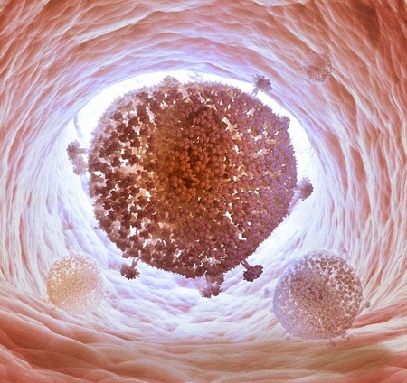 Giới khoa học đã tìm ra cách loại bỏ vi rút HIV