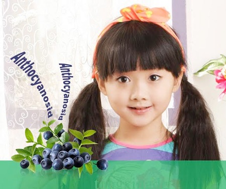 Cao Việt Quất từ Châu Âu - “Thần dược” phòng chống cận thị học đường - 2 Antɨocyanosid có trong