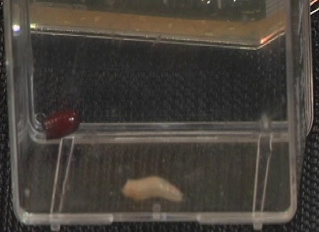 Điều trị vết loét ở người bệnh tiểu đường bằng... giòi - 1 Điều trị vết loét ở người bệnh tiểu đường bằng... giòi