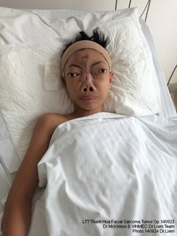 Bất ngờ gặp lại “cậu bé không có mặt” - 1 Lê Trung Tuấn khi còn là 1 em bé