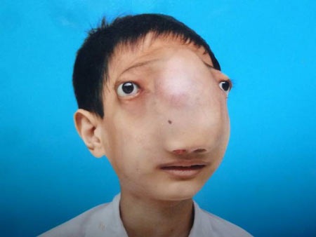 Bất ngờ gặp lại “cậu bé không có mặt” - 4 Lê Trung Tuấn khi còn là 1 em bé