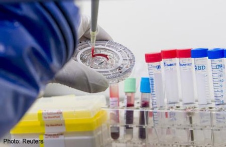 Kêu gọi hiến máu để điều trị bệnh Ebola - 1 Kêu gọi hiến máu để điều trị bệnh Ebola