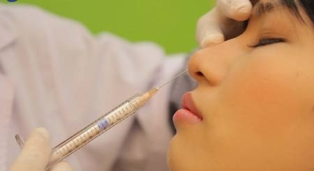 Nhiễm trùng sau nâng mũi: 8 lần điều trị vẫn không hết - 1 Lần khắc phục hậu quả thứ 8