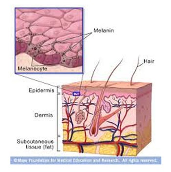 Mờ nám và tàn nhang với tinh chất Nhau thai cừu - 1 Melanin là nguyên nhân gây ra nám