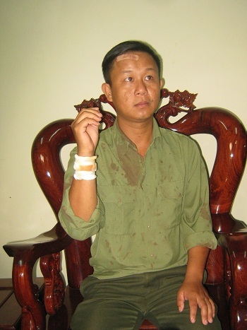 Anh Lê Quang Hòa với các vết thương trên người