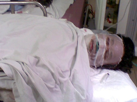 Vũ Duy Hiến đang nằm cấp cứu tại bệnh viện