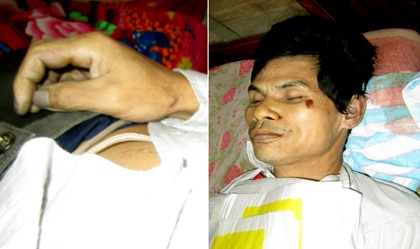 Những dấu tích trên thi thể nạn nhân Quệ.