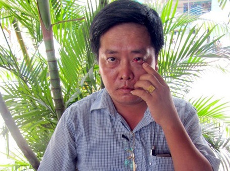 Đại úy Quang bị bị đánh gây thương tích ở mắt