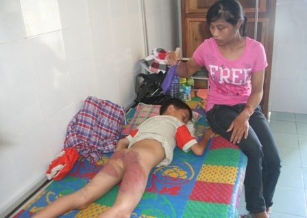 Đề nghị tước danh hiệu CAND công an đánh cháu bé 11 tuổi “quá tay” - 1